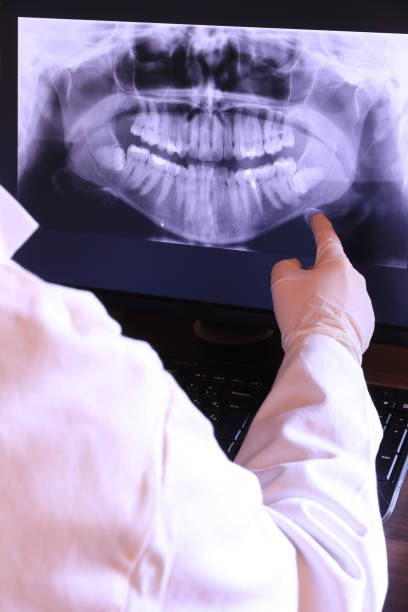 Best Emergency Root Canal Treatment in Redland, MD